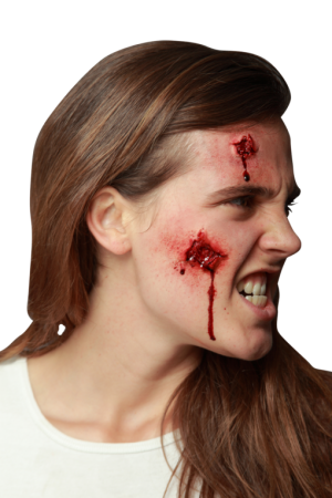 OPEN WOUND APPLIANCE